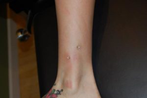 Ankle Piercing